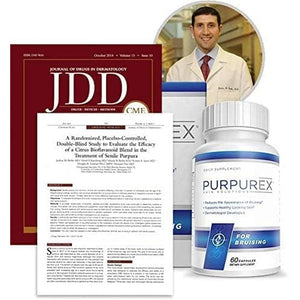 Dietary Supplement for Bruising (30-Day Supply)