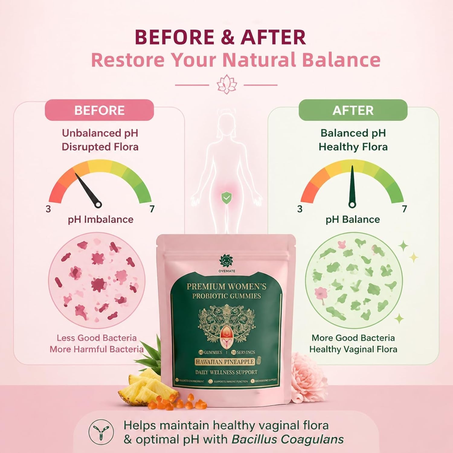 Women'S Probiotic Gummies – Feminine Ph Balance Probiotics Gummies & Vaginal Flora Support – Digestive Health – Vegan, Gluten-Free – Hawaiian Pineapple Gummy – 60 Count (30 Servings)（P1）