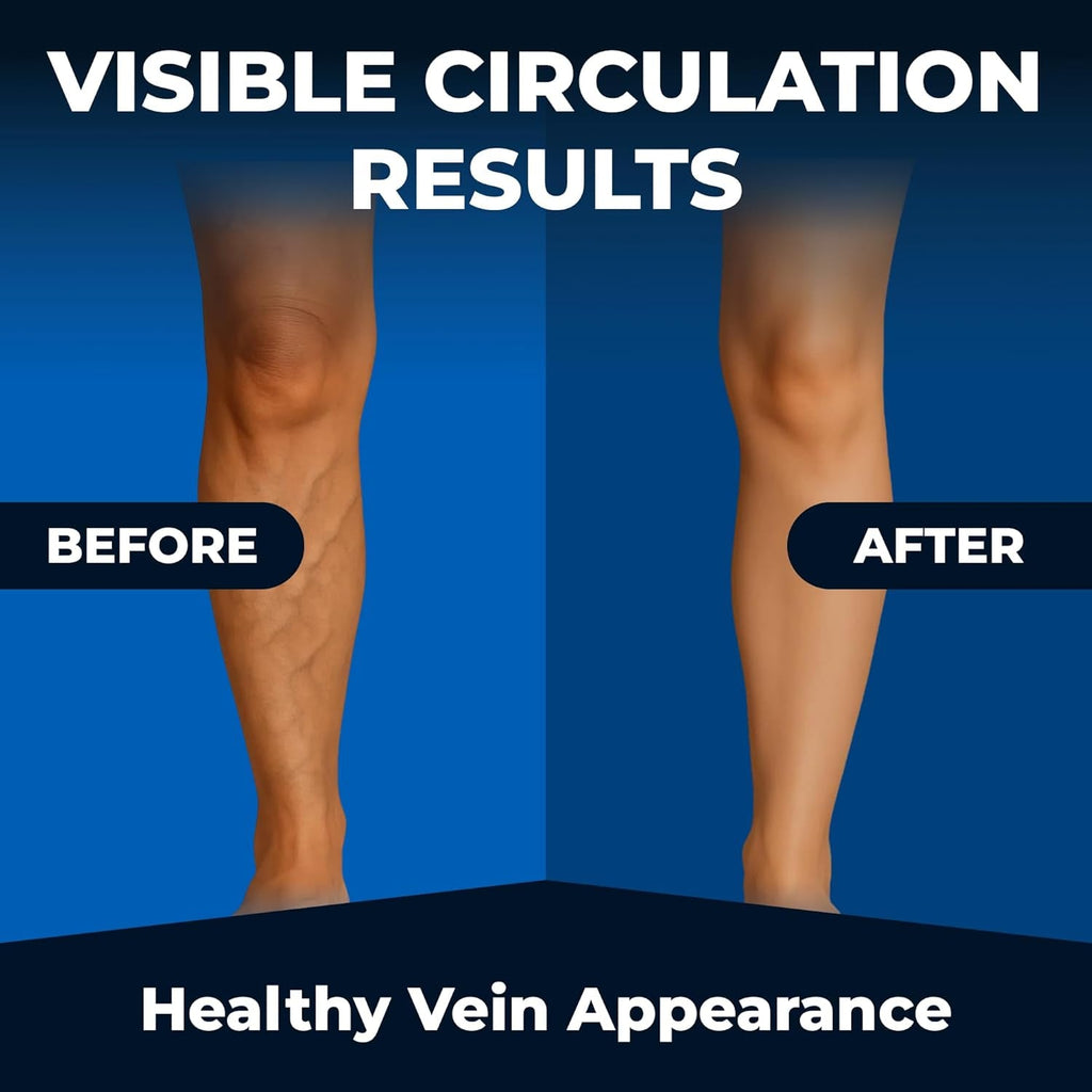 We like Vitamins Vein Vitality 1250Mg Diosmin Hesperidin Complex for Varicose Veins Treatment, Horse Chestnut, Butchers Broom, Bioflavonoids - Supports Blood Circulation for Leg Veins- 60 Capsules