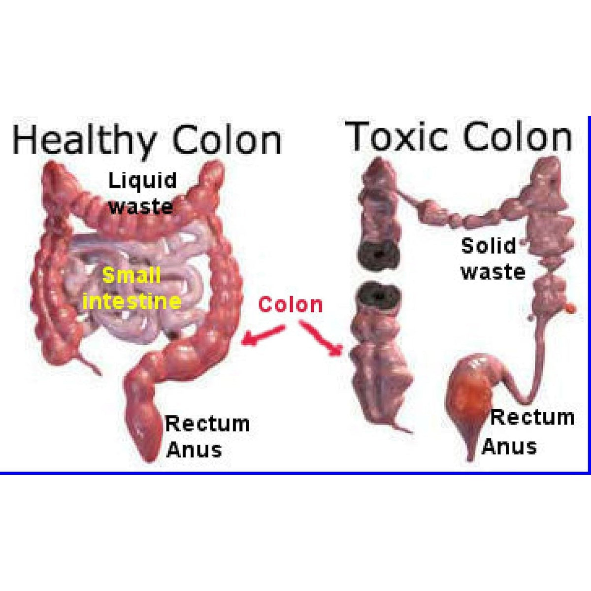 The One Minute Miracle - Miracle Oxy-Colon Cleanse - Colon Cleanser for 2 Day Cleanser
