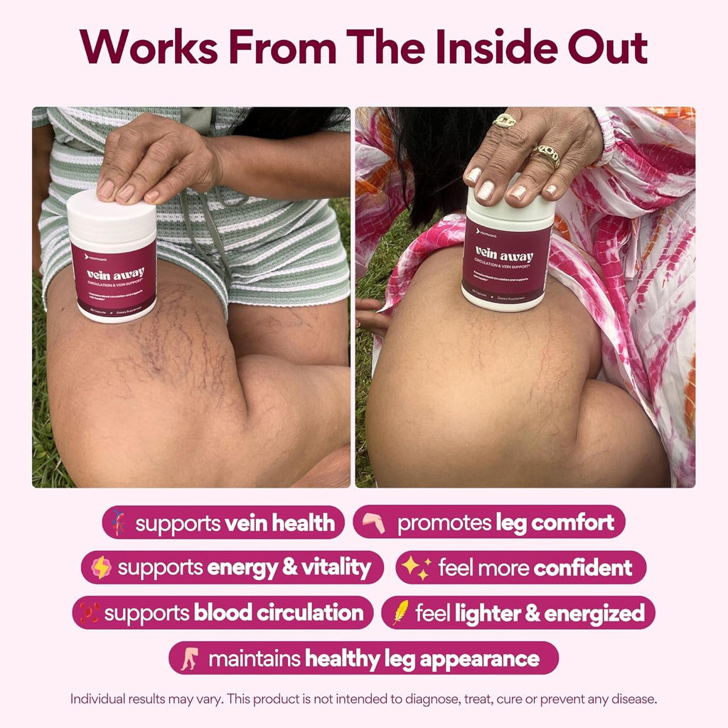 Voomvaya Vein Away – Blood Circulation & Vein Support Supplements for Women 35+ | Spider Veins & Varicose Veins Treatment for Legs | Circulation and Vein Support W/Diosmin & Hesperidin | 60 Capsules