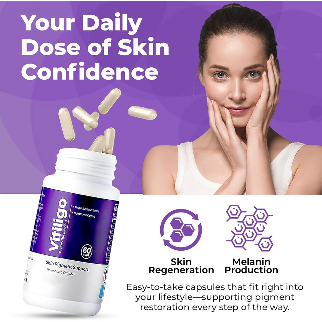 Vitiligo Capsules 60 Count | 1 Month | Improve Skin Pigmentation Support and Reduce White Spots | Effective Vitiligo Supplement | Natural Solution for White Spots on Skin. (1)