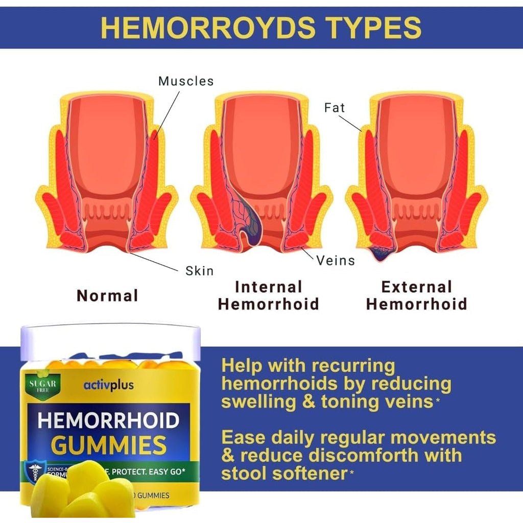 Hemorrhoid Treatment to Reduce Re-Occurrences & Easier Regularity with Stool Softener | 7 Clinically Studied Hemorrhoid Ingredients | Plant-Based Sugar Free Lemon 60 Vegan Gummies