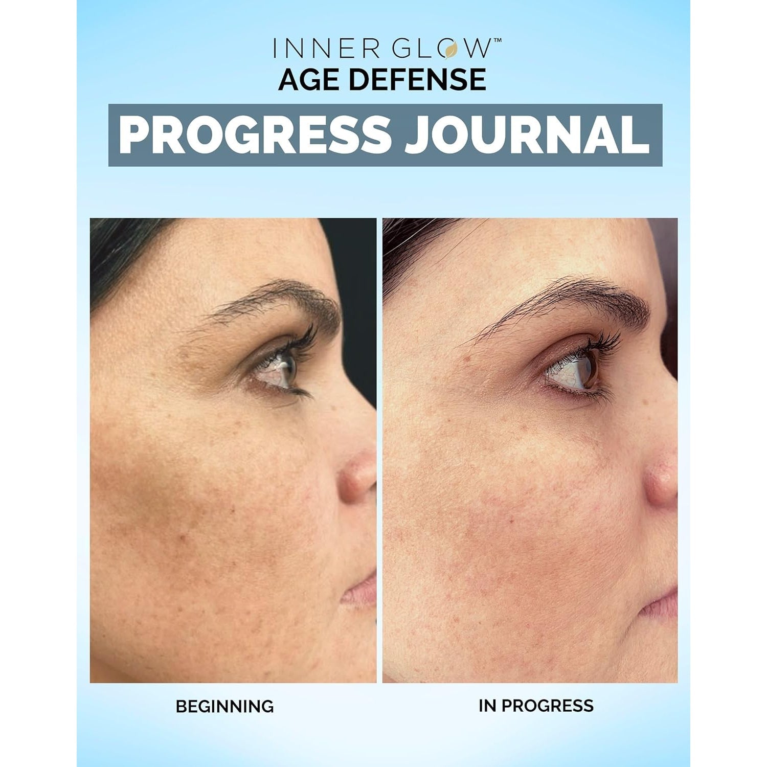 Inner Glow Age Defense Vitamins - Dermatologist and Plastic Surgeon Developed to Fight Photoaging and Melasma, Polypodium Leucotomos Antioxidant Formula – Vegan, Gluten-Free – 60 Capsules