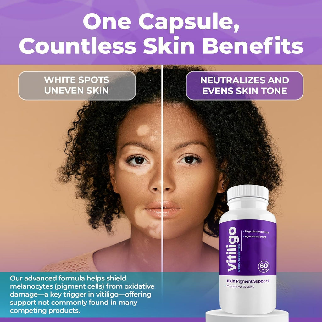 Vitiligo Capsules 60 Count | 1 Month | Improve Skin Pigmentation Support and Reduce White Spots | Effective Vitiligo Supplement | Natural Solution for White Spots on Skin. (1)