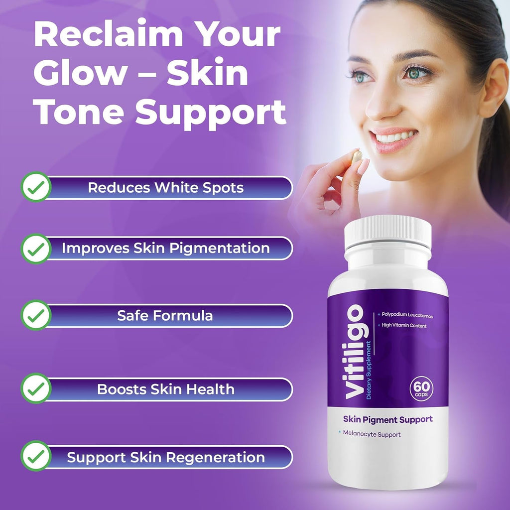 Vitiligo Capsules 60 Count | 1 Month | Improve Skin Pigmentation Support and Reduce White Spots | Effective Vitiligo Supplement | Natural Solution for White Spots on Skin. (1)