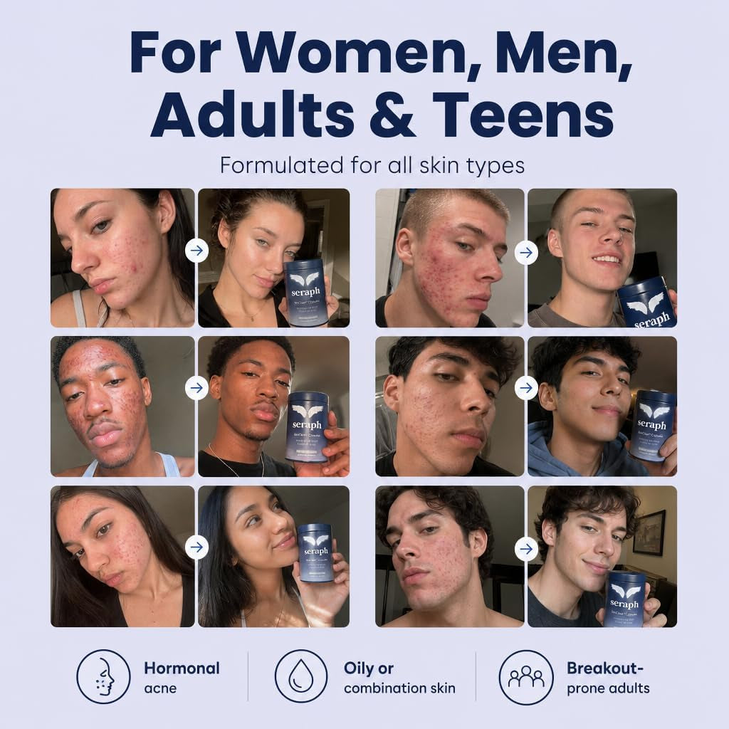 Seraph Acne Supplement - Hormonal Acne Pills Treatment - Pimple Supplements for Women - Skin Clear Capsules for Teen, Men, & Adults - Made in USA - 60 Tablets