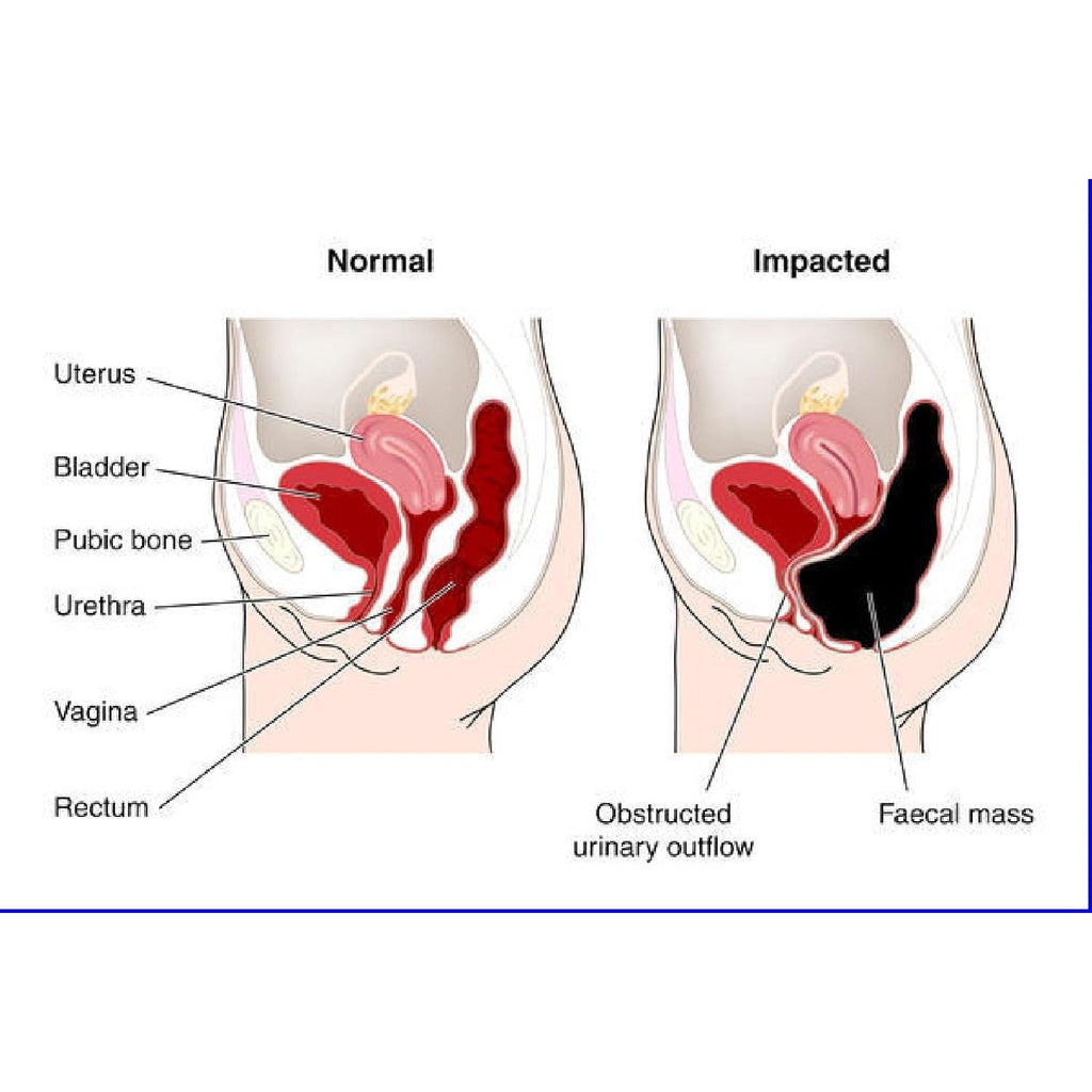 The One Minute Miracle - Miracle Oxy-Colon Cleanse - Colon Cleanser for 2 Day Cleanser