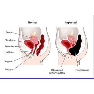 The One Minute Miracle - Miracle Oxy-Colon Cleanse - Colon Cleanser for 2 Day Cleanser