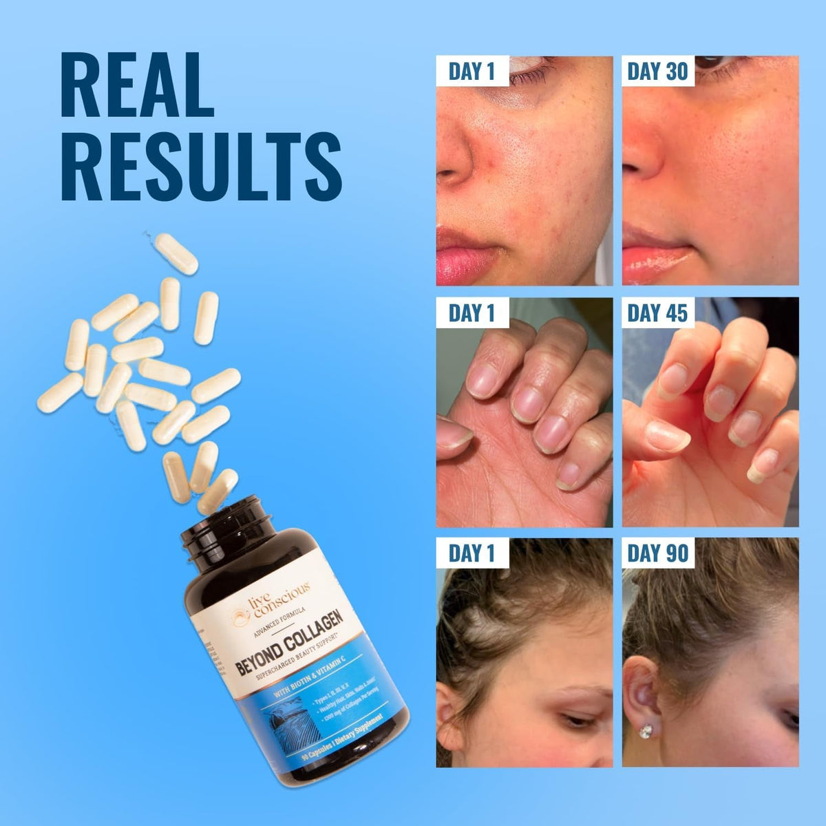 Live Conscious beyond Collagen Multi Collagen Capsules - Types I, II, III, V & X - Hydrolyzed Blend with Biotin & Vitamin C for Hair, Skin, Nails 90 Capsules