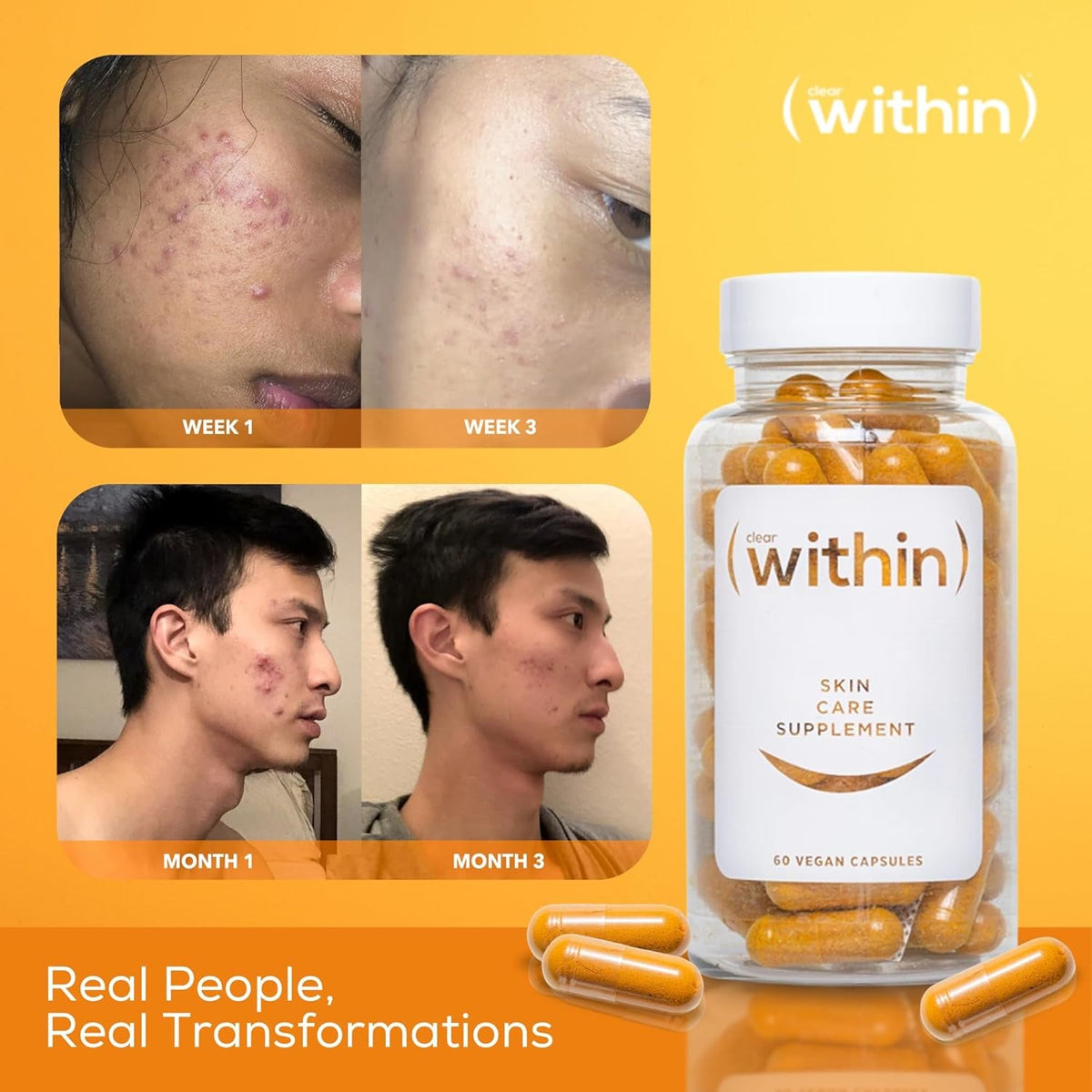 Clear within Clear Skin Vitamin - with 10 Natural Ingredients for Acne-Free, Clearer Complexion, Oil Control & Blemish Minimization. Supports Skin Clarity | Non-Synthetic 60 Cap/Bottle